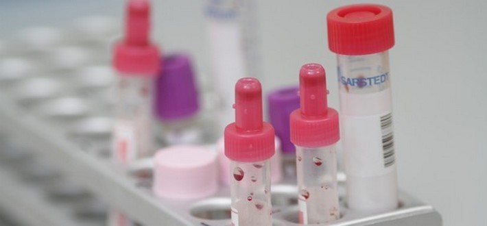 test tubes