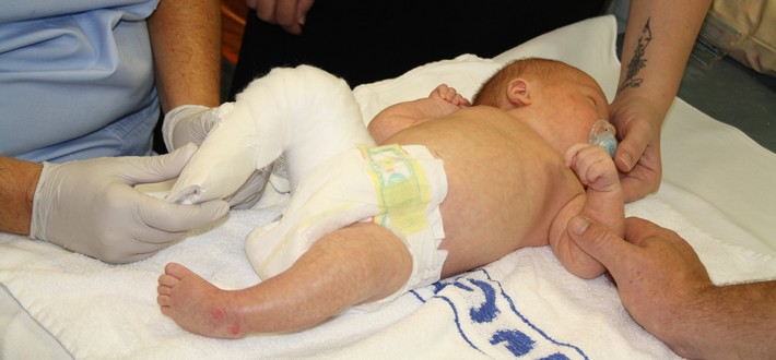 baby in a leg cast