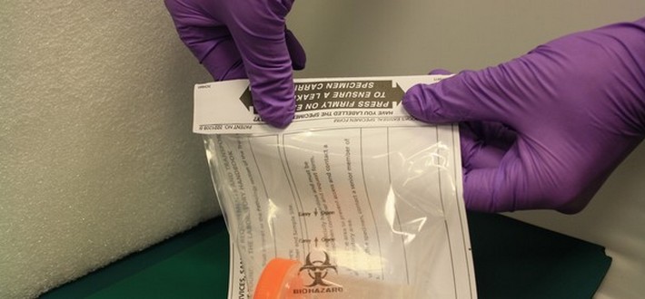 Packing a sample